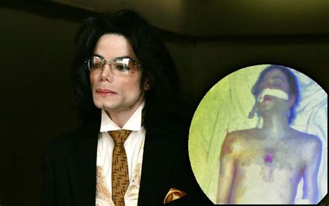 michael jackson autopsy photo|Jurors view Michael Jackson autopsy photo